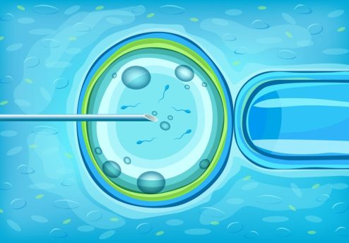 In Vitro Fertilization