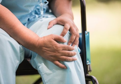 Total knee replacement